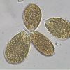 Foto 2 Cellule di Ostreopsis ovata fotografate al microscopio mentre “nuotano”. Foto di M. Abbate